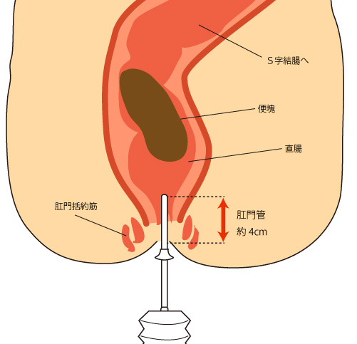 肛門部、肛門括約筋、直腸